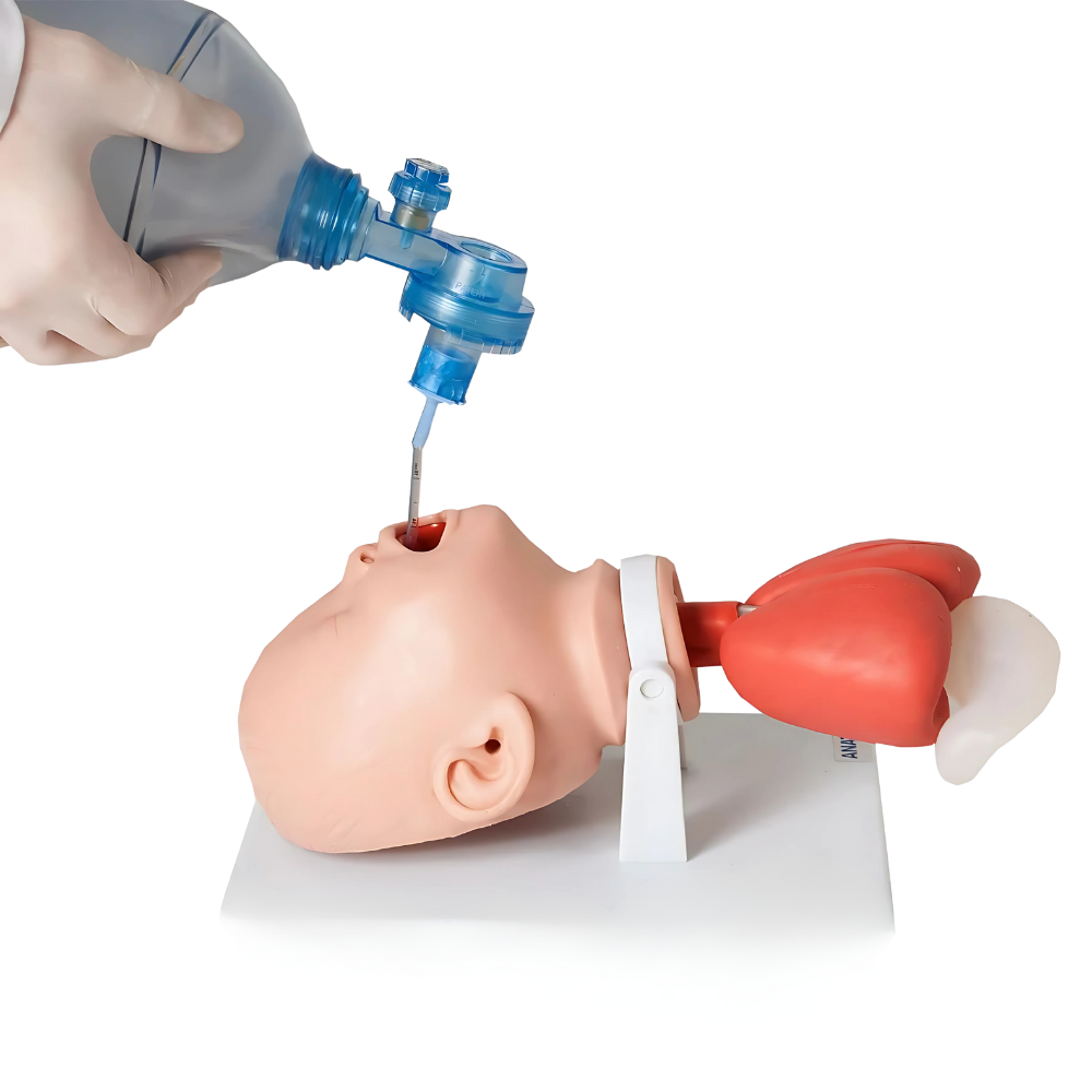Intubação Orotraqueal em Pacientes Neonatais: Informações importantes!