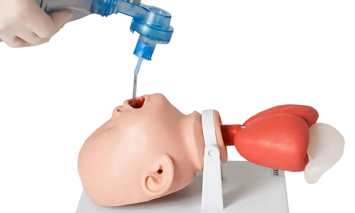 Intubação Orotraqueal em Pacientes Neonatais